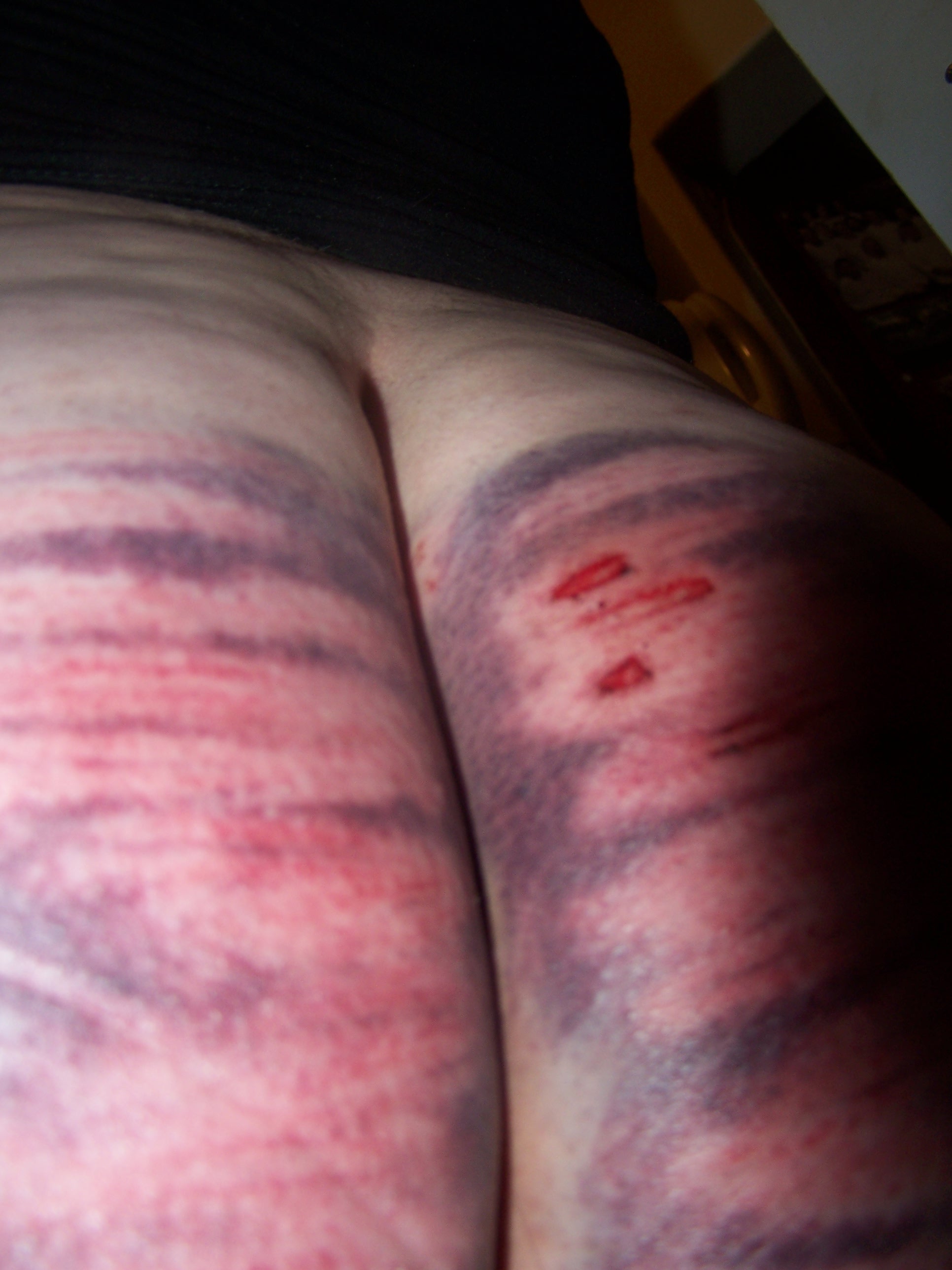 Bdsm Caning 115